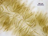 Organi pluriloculari
